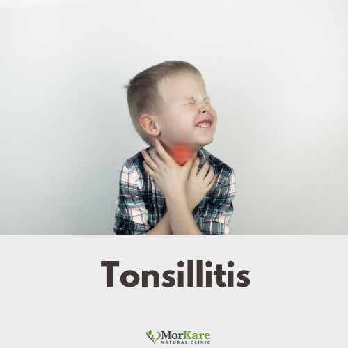 Tonsillitis in children, in adults, in todllers. Best Naturopath and Best Homeopath treatment for Tonsillitis