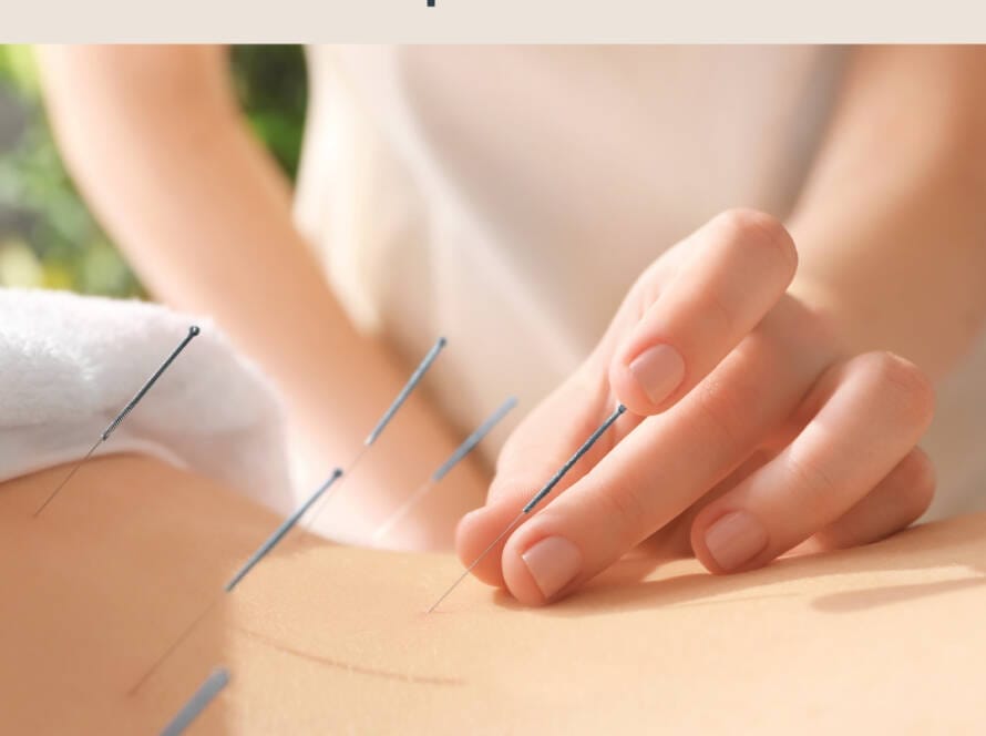 Acupuncture Brisbane Best Naturopath in brisbane for Fertility