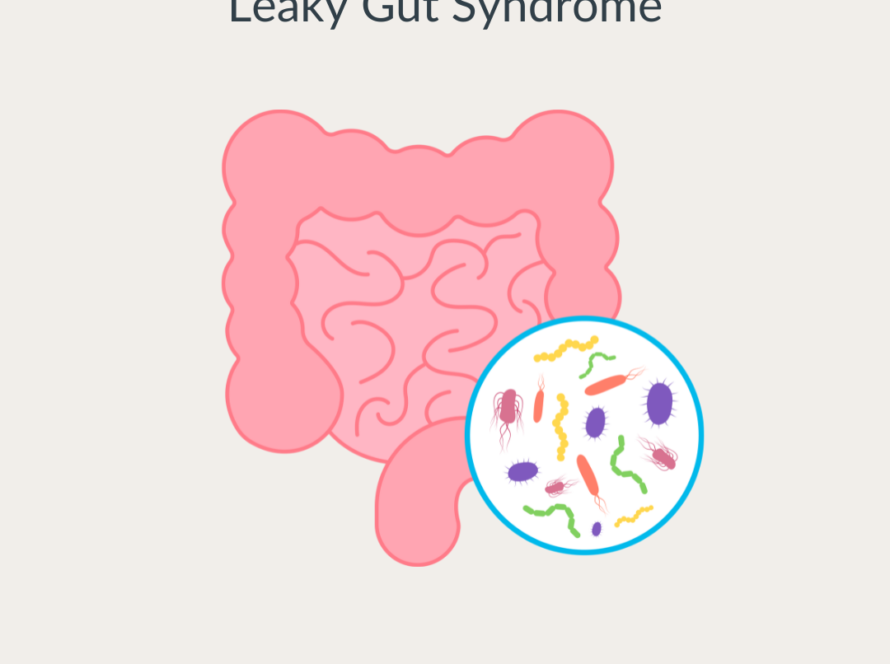 Leaky Gut Syndrome . Brisbane best Naturopath Homeopathy for Gut health