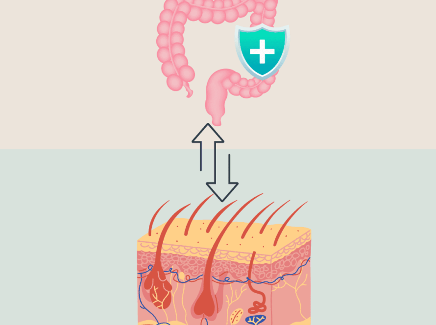 The gut-skin axis underscores the intimate connection between gut health and skin conditions. Imbalances in gut flora or digestive function can manifest as skin issues such as acne, eczema, or psoriasis. By optimizing gut health through dietary adjustments, probiotics, and naturopathic therapies, we aim to alleviate skin symptoms and promote long-term skin health.